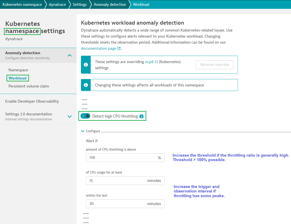 over-alerting-settings.png